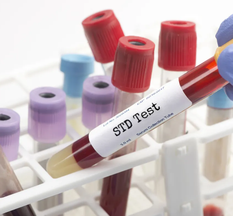 Sexually transmitted Desease testing